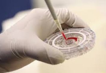 Конго-Қырым геморрагиялық қызбасы қалай жұғады?