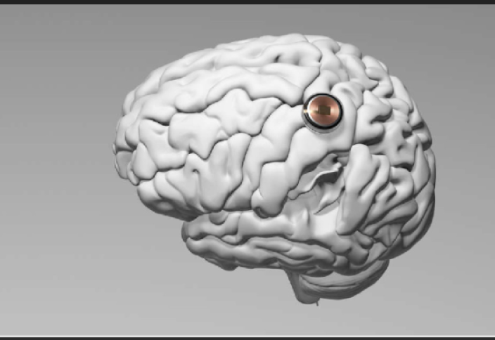 Мужчина с чипом Neuralink научился управлять самолетом силой мысли (видео)