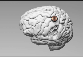 Мужчина с чипом Neuralink научился управлять самолетом силой мысли (видео)