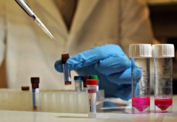 Эбола вирусын 20 000 адам жұқтыруы мүмкін