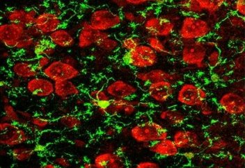 Ми жасушаларын жоятын ішек бактериясы табылды