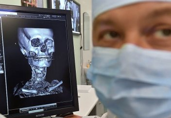 Искусственный интеллект научили определять уровень глюкозы в крови по ЭКГ