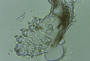 Бунақ аяқты құрт сіздің денеңізде тіршілік етеді