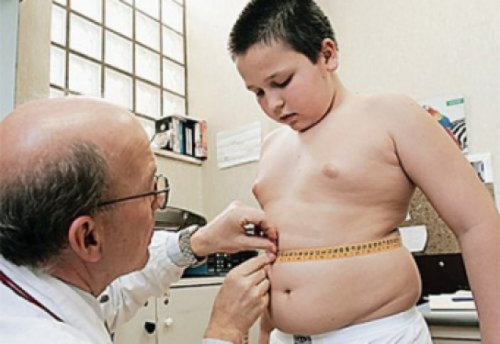 Лишний вес у подростка. Адипозогенитальная дистрофия. Ожирение у подростков. Ожирение у подростков мальчиков.