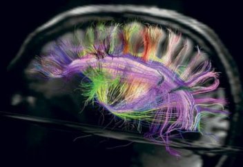 ПОСТ УЛУЧШАЕТ РАБОТУ МОЗГА