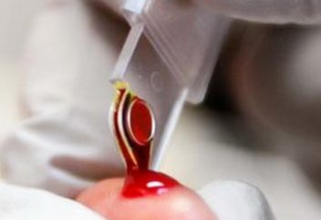 Ғалымдар семіздіктің ел білмеген қаупін ашты