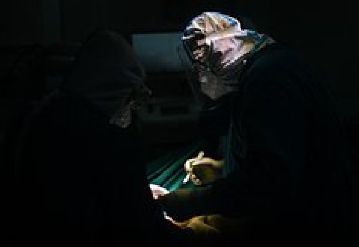 Пациент за 17 лет вырастил камень в слюнной железе и решил от него избавиться