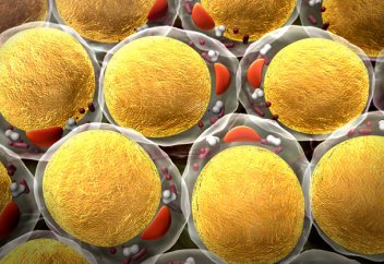 Семіздікпен радикалды күрес: майды терлеу арқылы сыртқа шығарып, арықтау тәсілі