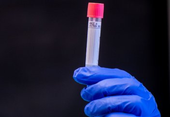 Биологи открыли новый половой гормон