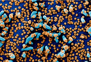 Коронавирусы оказались мастерами мимикрии. Японские ученые выяснили, как определить тяжесть COVID-19