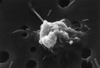 Ғылым әлеміндегі ең азалы көрініс: жасушаның өлуі (видео)