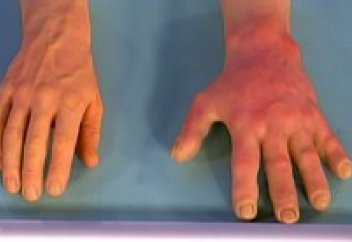 Әлемді айрықша ауру жайлап барады