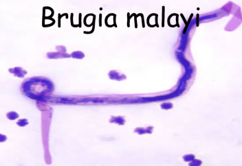 Зат алмасу жолдарын жабу арқылы қауіпті паразитті жоюдың тәсілі табылды