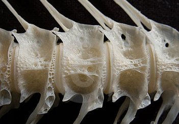 Ғалымдар кейбір адамдардың неліктен "сүйегі ауыр" болатынын анықтады