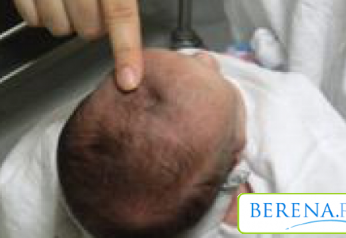 Іштен жарып алу баланың миына кері әсер етеді