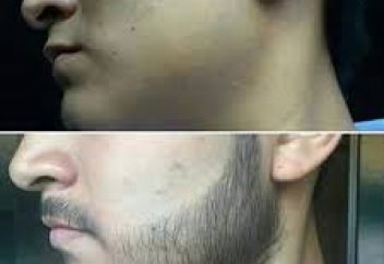 Дерматолог дәрігер сақалдың үш пайдасын айтты