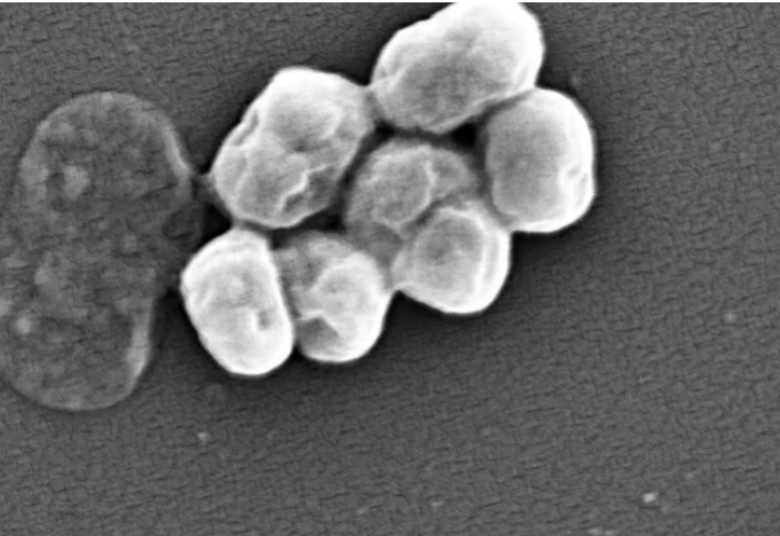 Бактериофаг аса қауіпті супербактерияны жоя алатын болып шықты