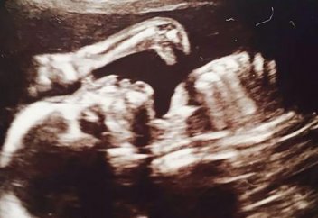 Құрсағында динозавр да бар болып шықты