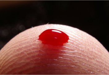 ҚАН ҚҰЮ АРҚЫЛЫ ҚАРТАЮ ПРОЦЕСІН ТОҚТАТУҒА БОЛАДЫ