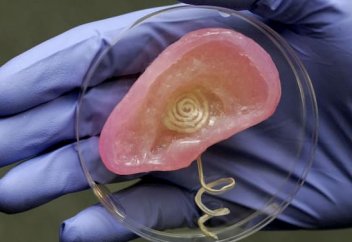 Адамға қолдан өсірілген құлақ тігілді