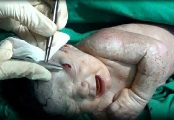 Ананың құрсағы нәрестені ракетаның жаңғышағынан сақтап қалған..