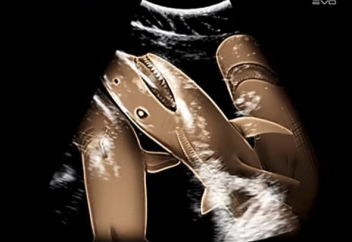 Жануарлар әлемі: Ғалымдар алғаш рет акула құрсағындағы балаларын суретке түсірді (видео)