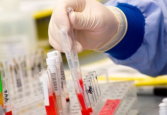 «Свадебный переполох» начать с проверки на ВИЧ