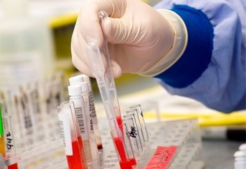 «Свадебный переполох» начать с проверки на ВИЧ