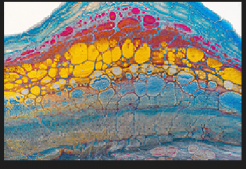 Қатерлі ісікке қарсы жаңа дәрі. Қатерлі ісікті жарықпен бірнеше есе тиімді жолмен емдеу тәсілі табылды