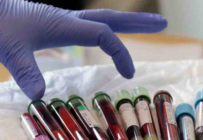 Адамды тірі қалдырмайтын екі вирусқа қарсы антидене табылды