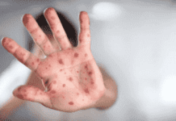 Екпеден бас тартуға тыйым салынады