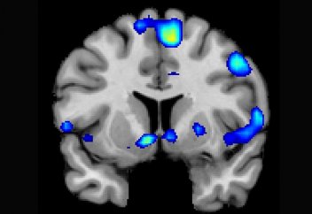 Құлшылық кезіндегі мидағы өзгерістер – жаңа зерттеу (фото)
