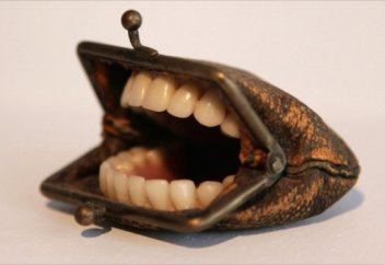 Как нас разводят стоматологи? Что нужно знать, чтобы не остаться без денег