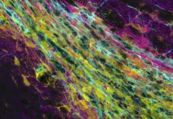 «Великое переселение» нейронов