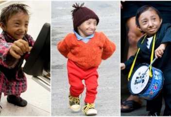 Әлемдегі ең кішкентай адам дүниеден өтті (видео)