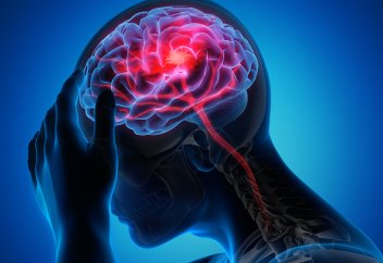 2050 жылға қарай әлемде инсулттан қайтыс болатындар саны 50 пайызға артады