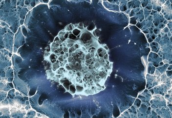 Внутренние бомбы