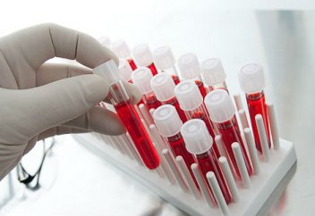 Елордалық дәрігерлер туберкулезді 10-15 минутта анықтайтын жаңа әдісті енгізді