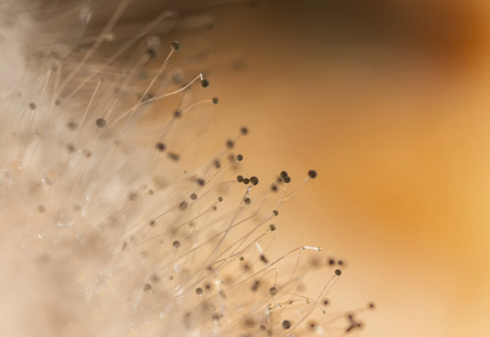 В Японии обнаружен смертельно опасный патоген, устойчивый к лечению