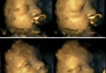 Анасы темекі тартқанда шарананың жантүршігерлік халі (ВИДЕО)