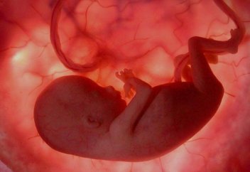 Адам ба­ла­сы­ның дү­ниеге ке­луі