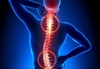 Остеохондроз қалай пайда болады?