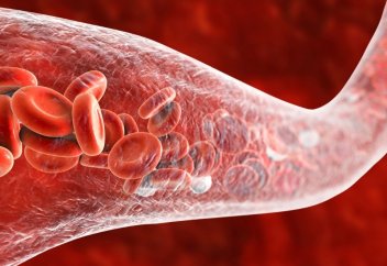 Тамырдағы микропластиктің инфаркт пен инсультке ұрындыру қатері жоғары болып шықты