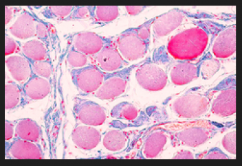 Тері жасушаларын жасартудың тың тәсілдері табылды