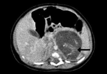 Гонконгта жаңа туылған сәбидің ішінде егіз баланың бары анықталды