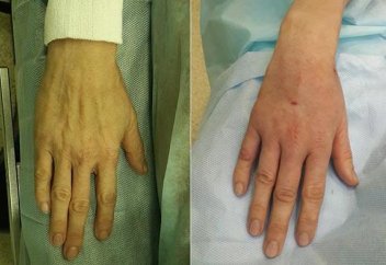 Ғалымдар адамды ДНК деңгейінде тұңғыш рет жасарта алды