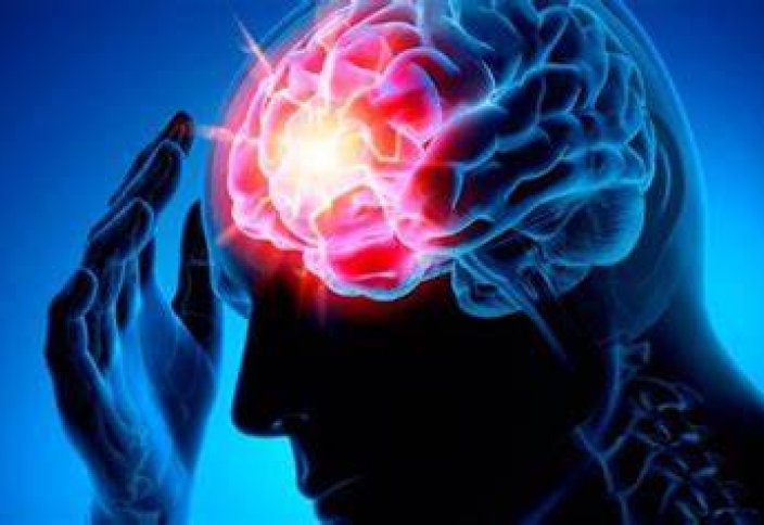 Ученые из США создали препарат, позволяющий быстро поправиться после инсульта