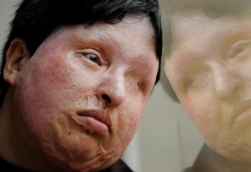 Сот үкімі бойынша қылмыскерді бір көзінен айырды