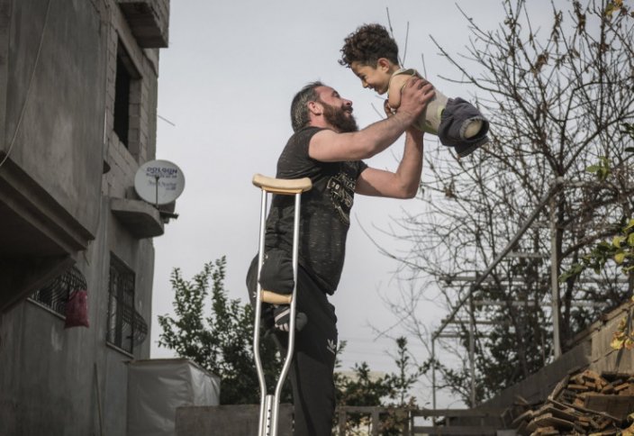 Фото отца с сыном без ног и рук победило на конкурсе Siena International Photo Awards (фото+видео)