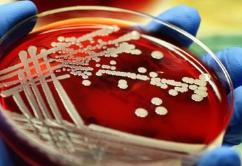 Антибиотиктің тиімділігін арттырудың тың тәсілі пайда болды